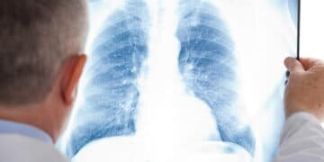 Статистику по КВИ и «неизвестной» пневмонии объединят в Казахстане